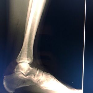 Meet your Posher, Amin